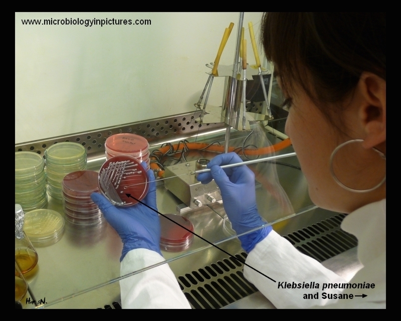 strains of K.pneumoniae